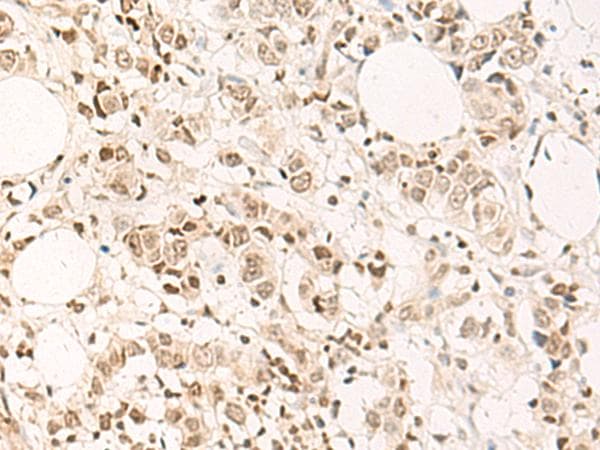 DPPA4 Antibody