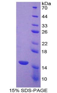 Mouse CASP7 / Caspase 7 Protein (Recombinant His-T7)