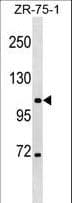 ClC-3 / CLCN3 Antibody (aa285-313)