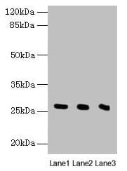NQO2 Antibody (aa1-231)