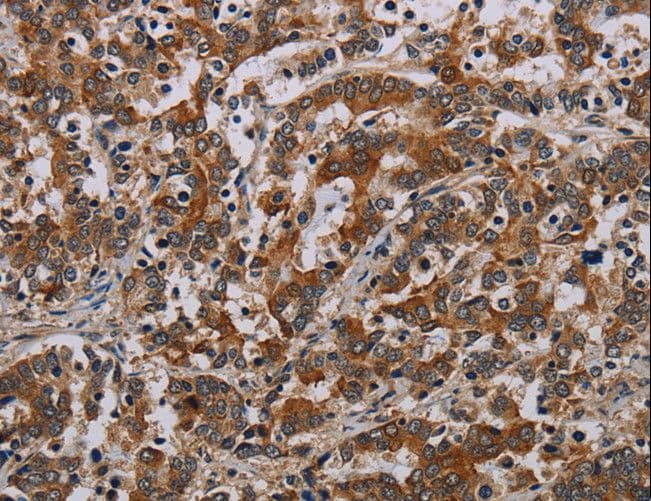NLRP9 Antibody