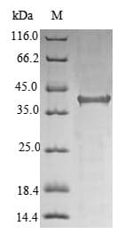 Human HFE Protein (Recombinant 10His, N-terminus + Myc, C-terminus)