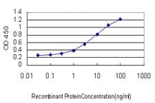 CILP Antibody (clone 2C5)