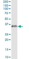 SCEH / ECHS1 Antibody (clone 1G9)