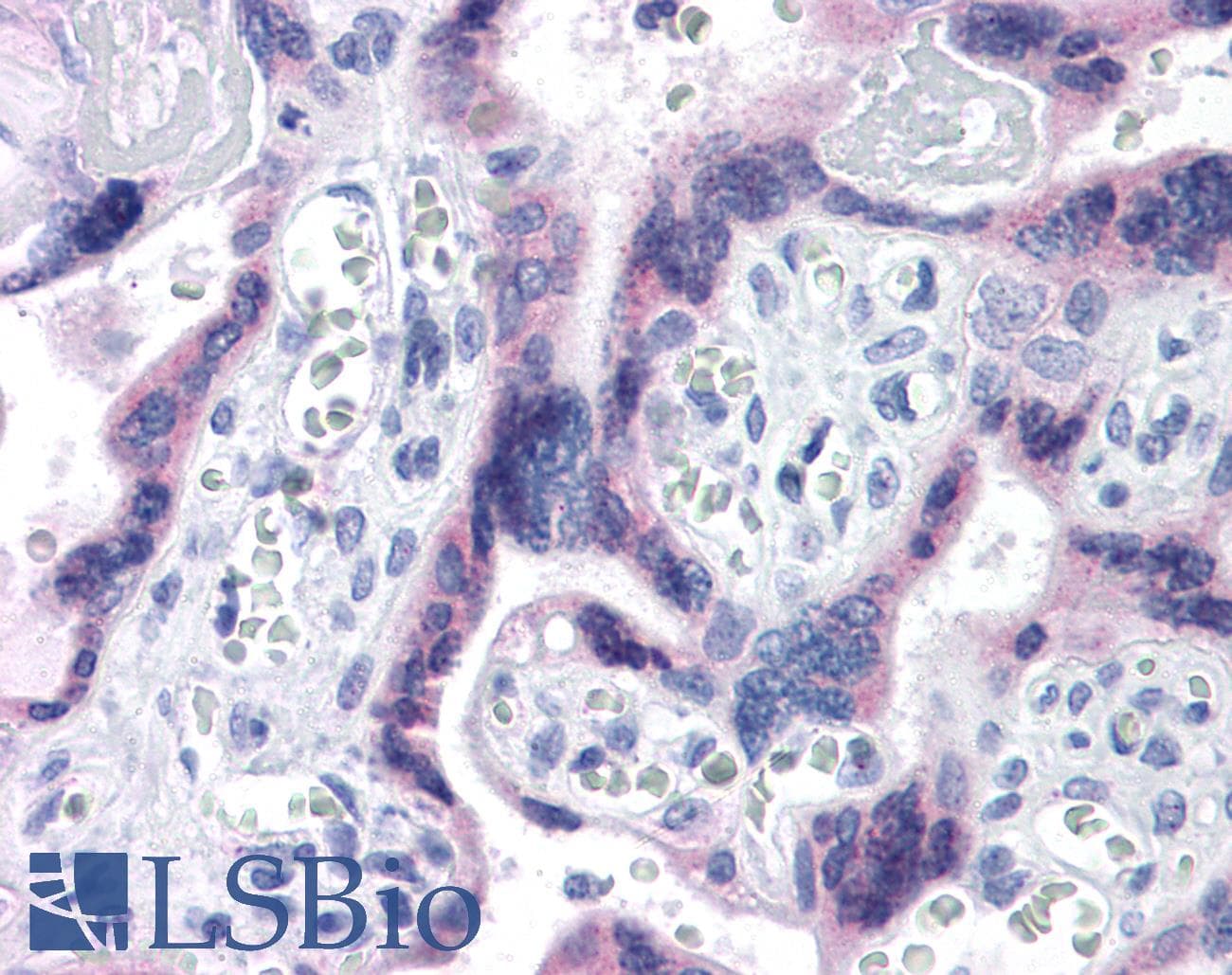 IHC-plus™ Polyclonal Rabbit anti-Human TTBK2 Antibody (IHC)