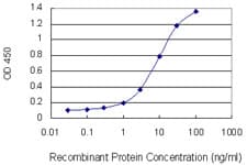 KRT10 / CK10 / Cytokeratin 10 Antibody (clone 1H6)