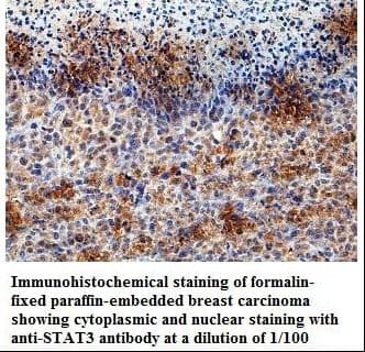 Polyclonal Rabbit anti-Human STAT3 Antibody (aa51-278, IHC, WB)