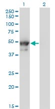 KRT8 / CK8 / Cytokeratin 8 Antibody (clone 3E3)