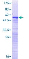 Human RP9 Protein (Recombinant GST)