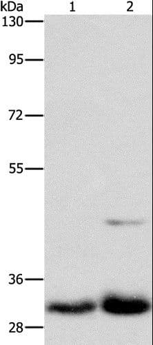 Polyclonal Rabbit anti-Human MPG Antibody (IHC, WB)