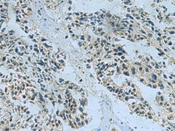 NDUFA2 Antibody