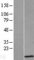 ATOX1 Protein (Over-Expression Lysate Myc-DDK (Flag))