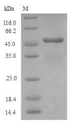 Human AQP1 / Aquaporin 1 Protein (Recombinant 6His-SUMO, N-terminus)