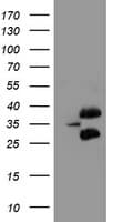 UBE2J1 Antibody (clone OTI2G2)