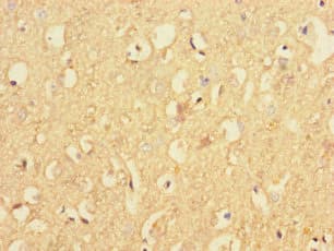 RAB40B Antibody