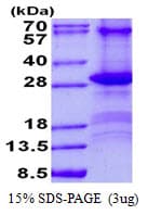 Human CD84 / SLAMF5 Protein (Recombinant His)