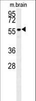 Monoclonal Mouse anti-Human AKT2 Antibody (aa214-451, IHC, IF, WB)
