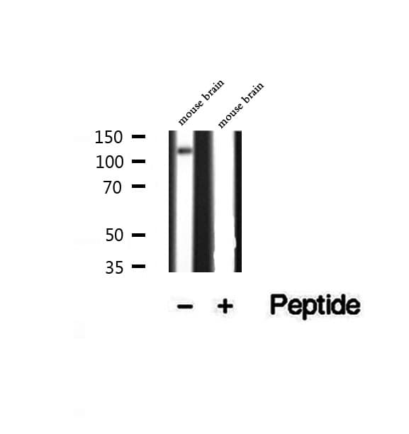 Polyclonal Rabbit anti-Human ATP8A1 Antibody (IHC, WB)