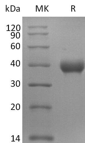 Coronavirus SARS-CoV-2 Spike Glycoprotein (Recombinant 6His, C-terminus)
