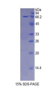 Mouse PRSS8 / Prostasin Protein (Recombinant His-GST)