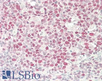 IHC-plus™ Monoclonal Mouse anti-Human XRCC4 Antibody (clone 5C10, IHC, WB)