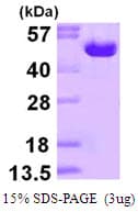 Human ODC1 / Ornithine Decarboxylase Protein (Recombinant His)