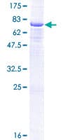 Human Carboxypeptidase A5 / CPA5 Protein (Recombinant GST)