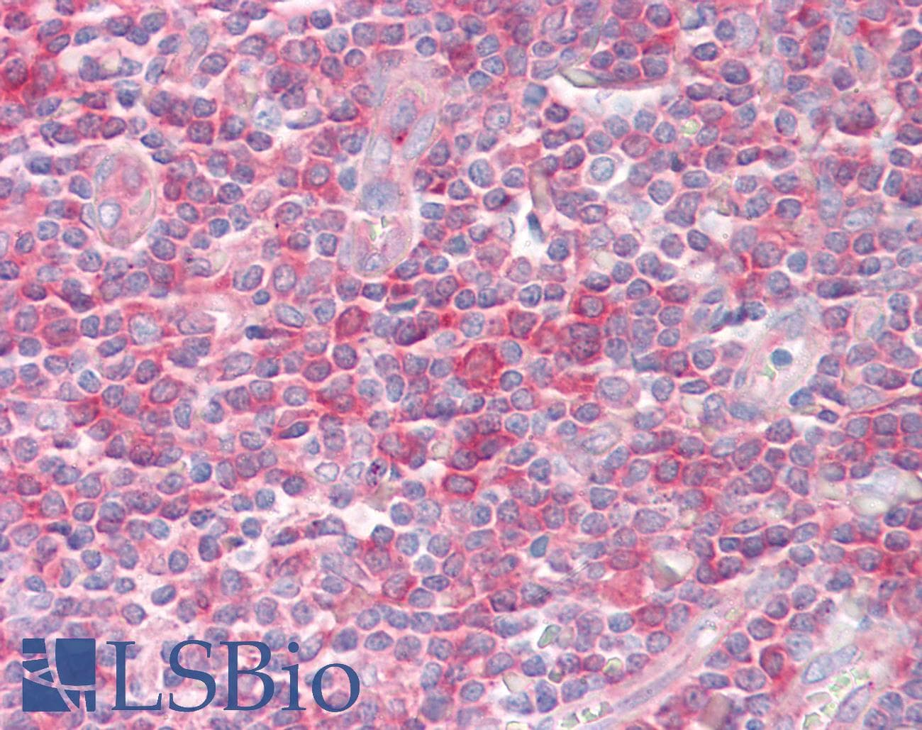 IHC-plus™ UBE1L / UBA7 Antibody (aa963-1012)