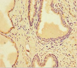 SMARCA1 / SWI Antibody