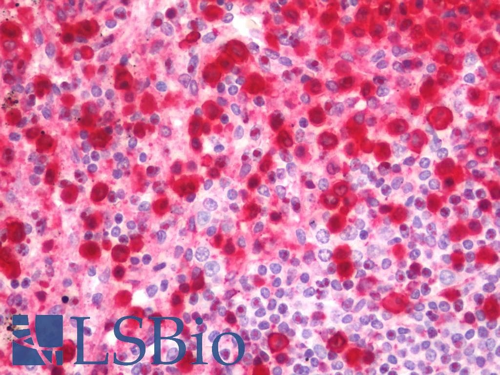 IHC-plus™ ANXA1 / Annexin A1 Antibody (aa97-146)