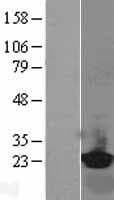 Human RBP4 Protein (Over-Expression Lysate Myc-DDK (Flag))