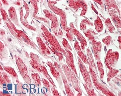 IHC-plus™ CDK4 Antibody (aa1-50)
