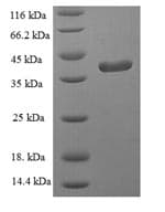 Human GPX1 / Glutathione Peroxidase Protein (Recombinant 6His-SUMO, N-terminus)