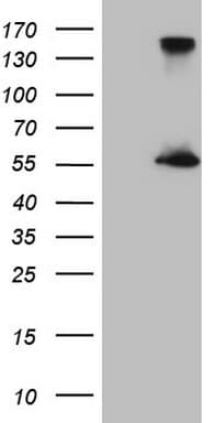 ESRRA / ERR Alpha Antibody (aa1-205, clone OTI9D10, Carrier-free)
