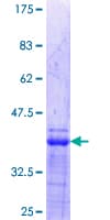Human ETS1 / ETS-1 Protein (Recombinant GST, N-terminus)