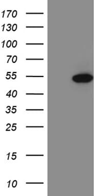 FOXP3 Antibody (clone OTI8D6)