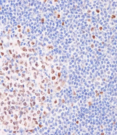 Monoclonal Mouse anti-Human MKI67 / Ki67 Antibody (IHC)