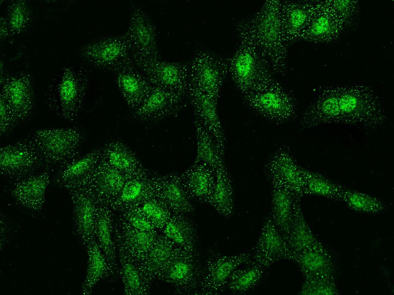Polyclonal Rabbit anti-Human SPATA5L1 Antibody (IF)