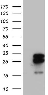 MRPS7 Antibody (aa38-242, clone OTI5E11)