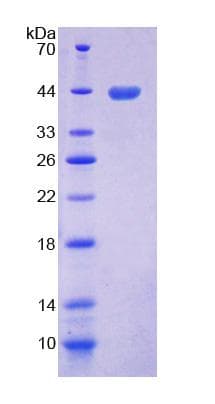 Mouse TLR1 Protein (Recombinant His-GST)