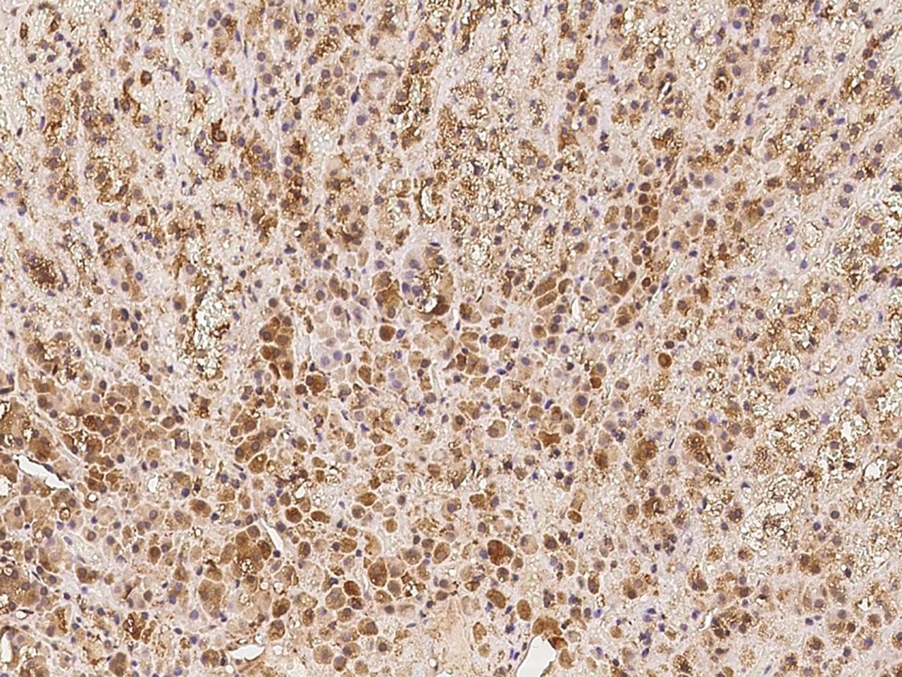 EID1 / EID-1 Antibody