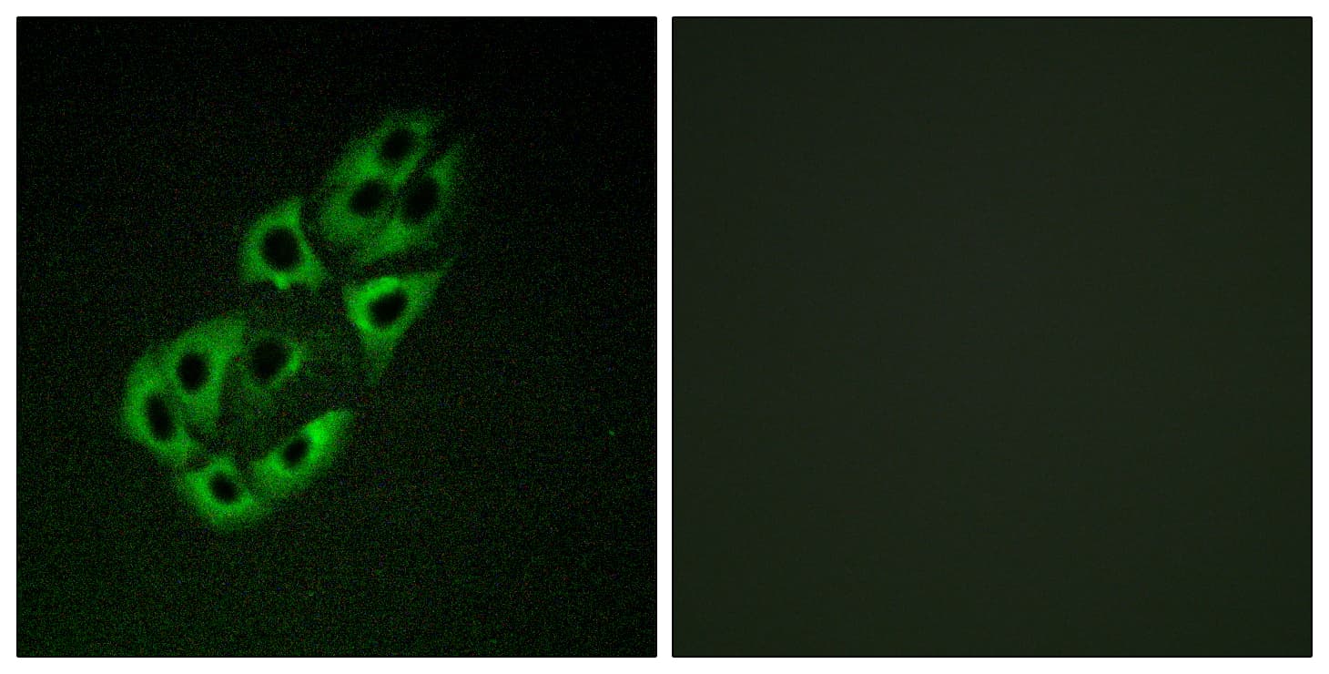 SSBP1 / mtSSB Antibody (aa99-148)