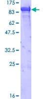 Human HSPA5 / GRP78 / BiP Protein (Recombinant GST, N-terminus)