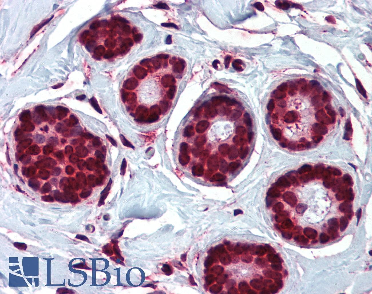 IHC-plus™ Polyclonal Rabbit anti-Human HELO1 / ELOVL5 Antibody (N-Terminus, IHC)