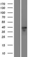 VSX2 / CHX10 Protein (Over-Expression Lysate Myc-DDK (Flag))