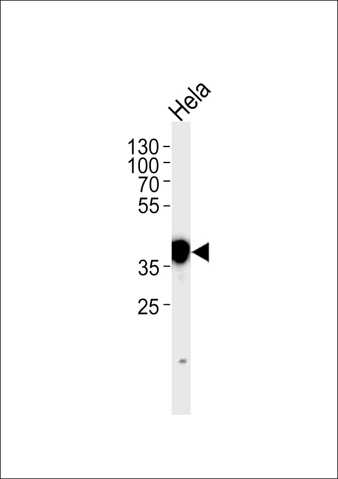 NPM1 / NPM / Nucleophosmin Antibody (aa7-33)