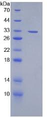 Mouse Lymphotoxin-Beta / LTB Protein (Recombinant His, N-Terminal)