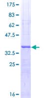 Human WNT5A Protein (Recombinant GST, N-terminus)