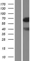 LSR / LISCH7 Protein (Over-Expression Lysate Myc-DDK (Flag))