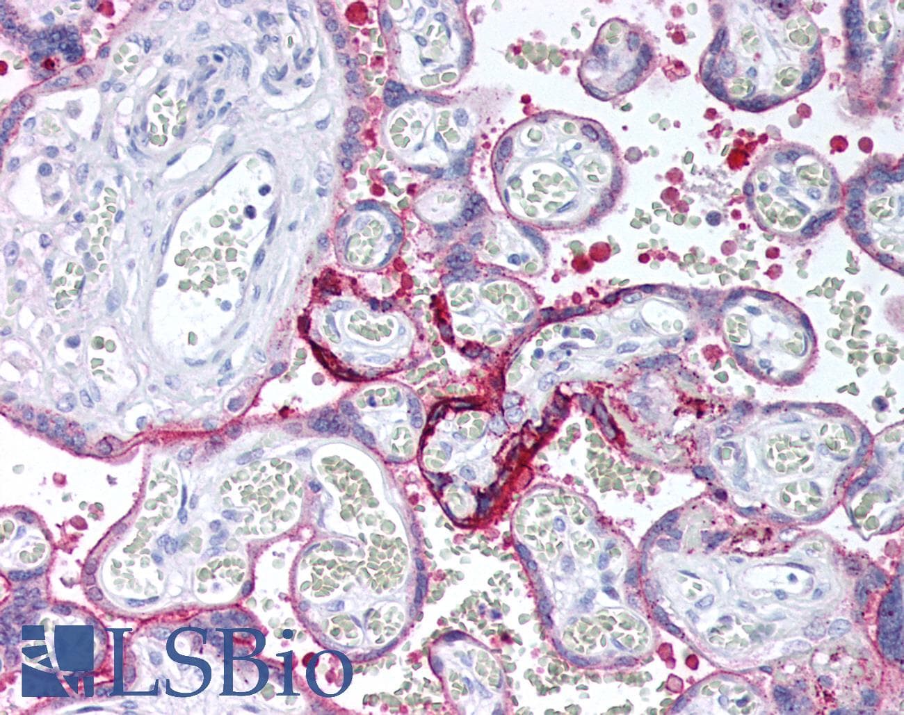 PathPlus™ ANXA1 / Annexin A1 Antibody